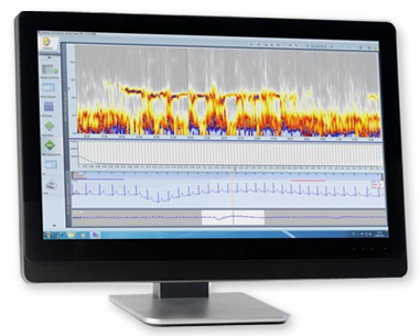 Medilog-DARWIN2 -hotler-ECG-recorder